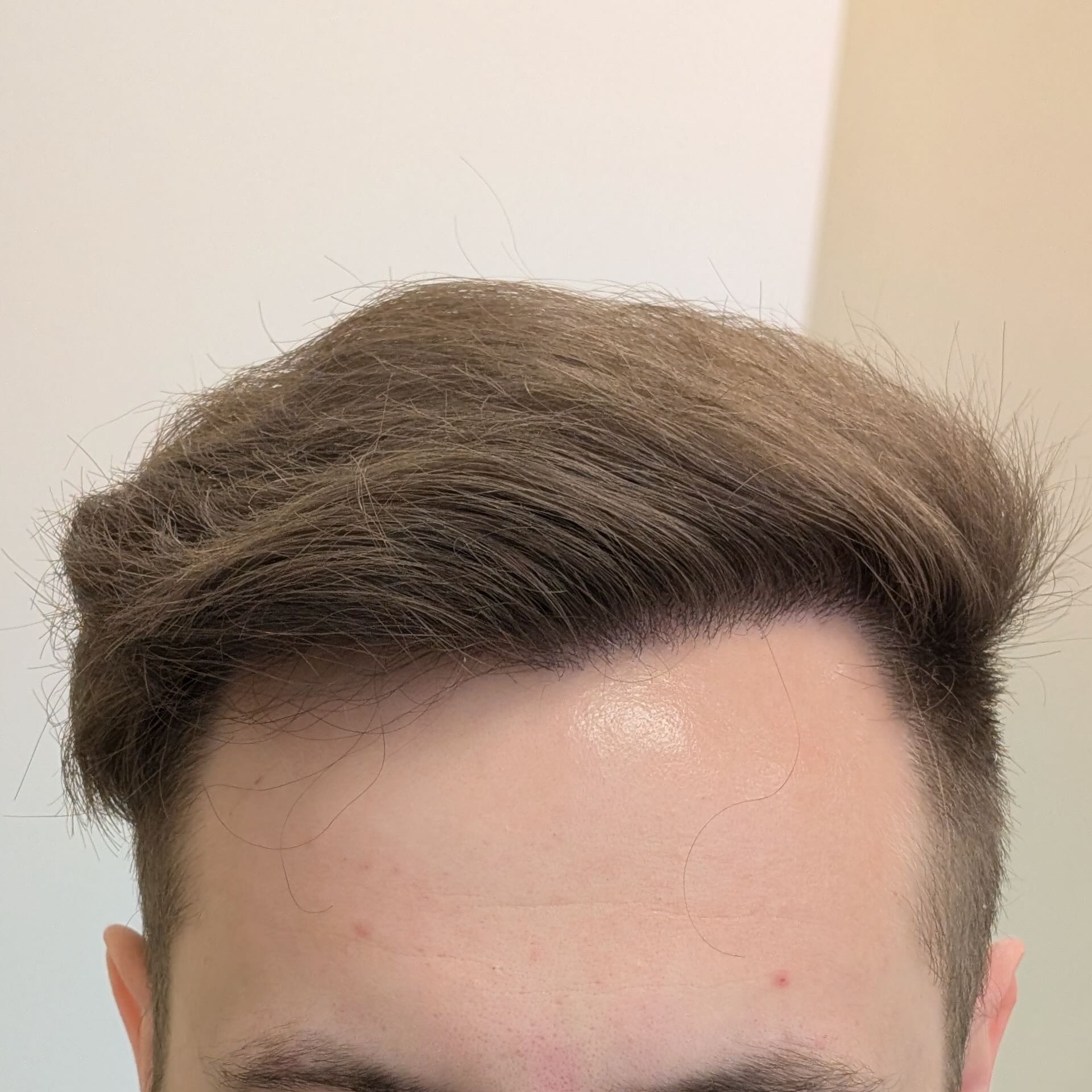 After