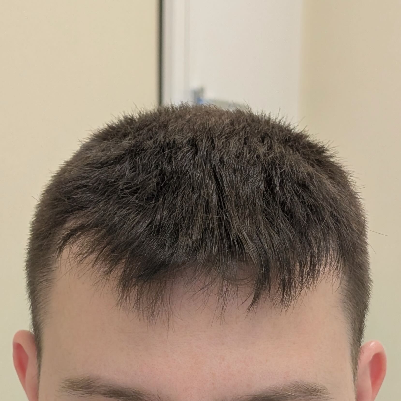 After