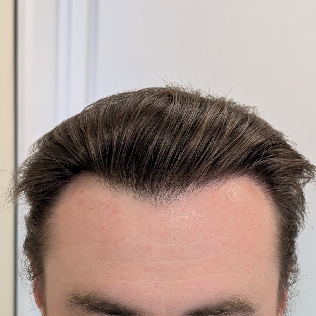 After